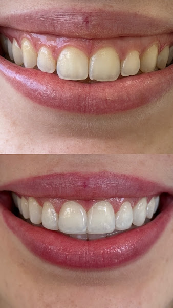 Foto 2 de Dra Camila Vassallo - Odontologia estética e reabilitadora