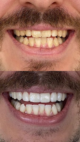 Foto 3 de Dra Camila Vassallo - Odontologia estética e reabilitadora