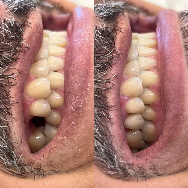 Foto 3 de DRA CAMILA VILA FLOR | ESTÉTICA OROFACIAL | IMPLANTES DENTÁRIOS