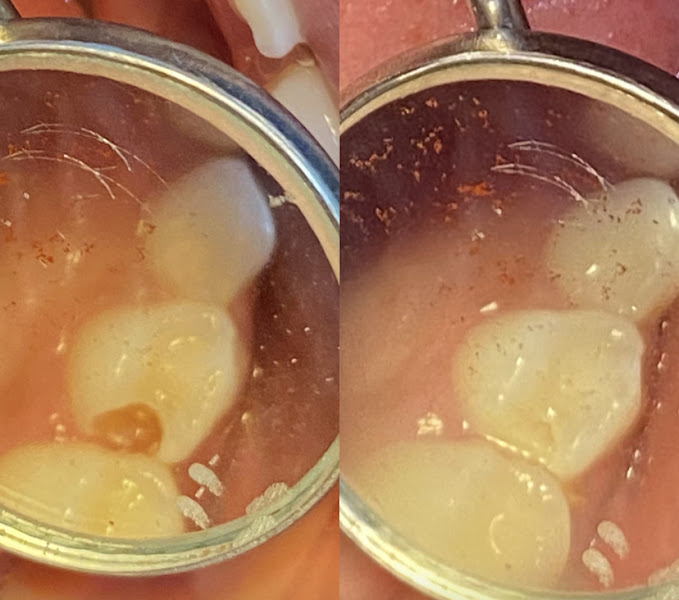 Foto 3 de Dra. Camili Melo - Cirurgiã Dentista