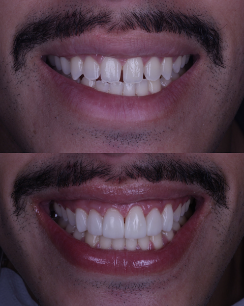 Foto 3 de Dra.Camilla Fortunato Odontologia