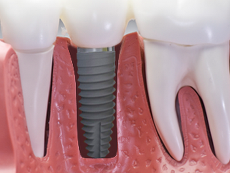 Foto 9 de Dra Camilla Grisotto | Dentista