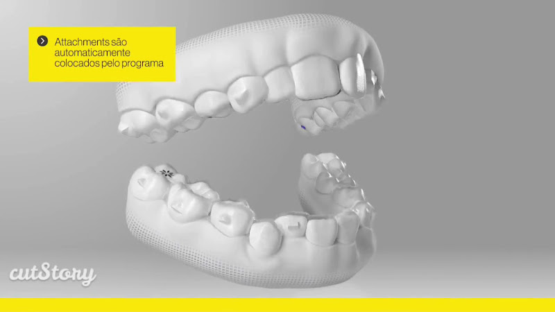 Foto 3 de Dra.Camille David - Ortodontista-Aparelho Ortodôntico em Vila Velha - Invisalign Doctor em Vila Velha