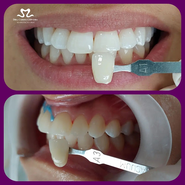 Foto 3 de Dra Carina Cerveira Harmonização Facial