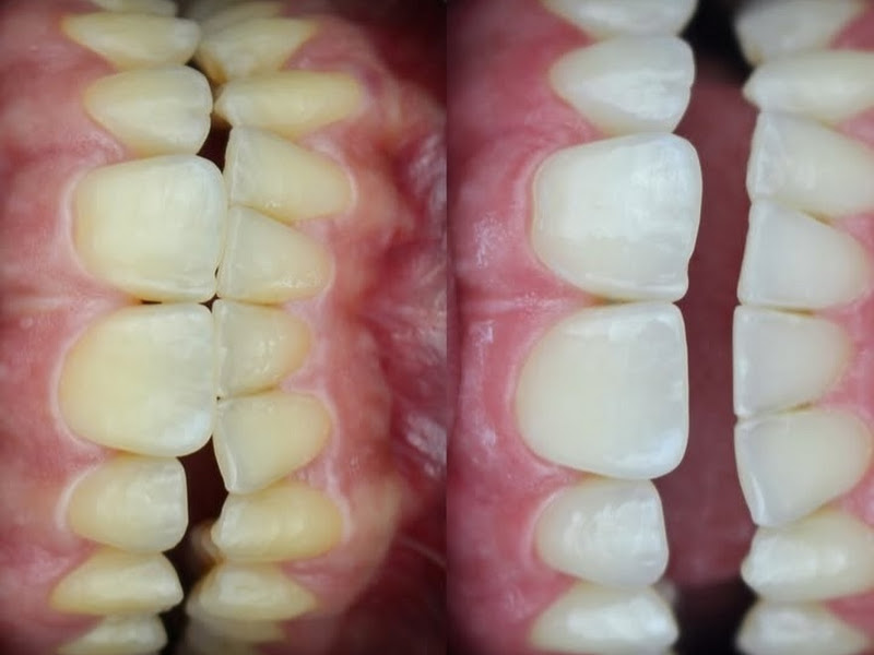 Foto de Dra.Carina Udulutsch Soares Odontologia Planalto Paulista,Moema e Região