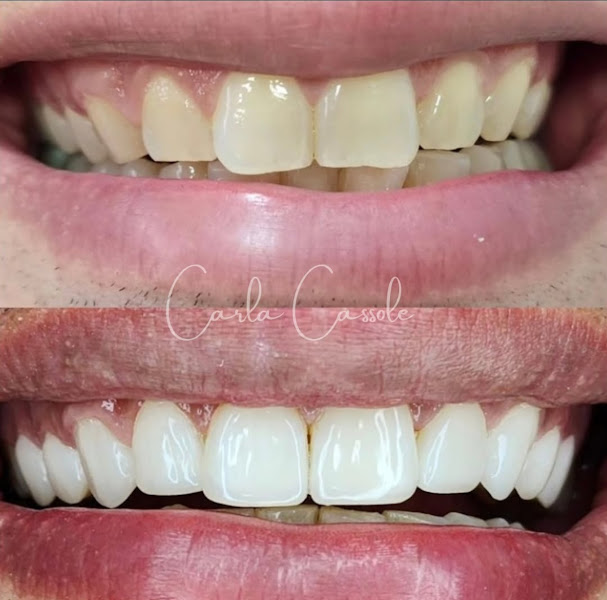 Foto 2 de Dra. Carla Cassole - Dentista em Bauru