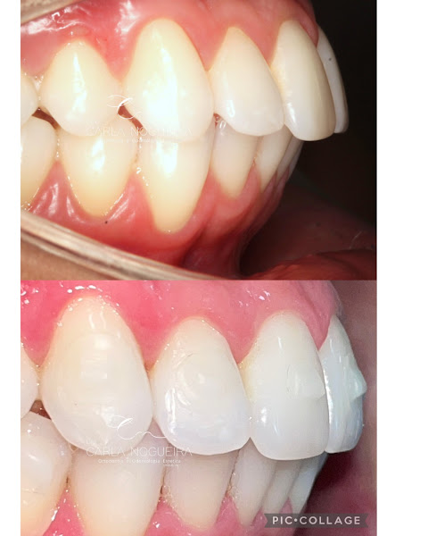 Foto 3 de Dra. Carla Nogueira Ortodontia e Odontologia Estética