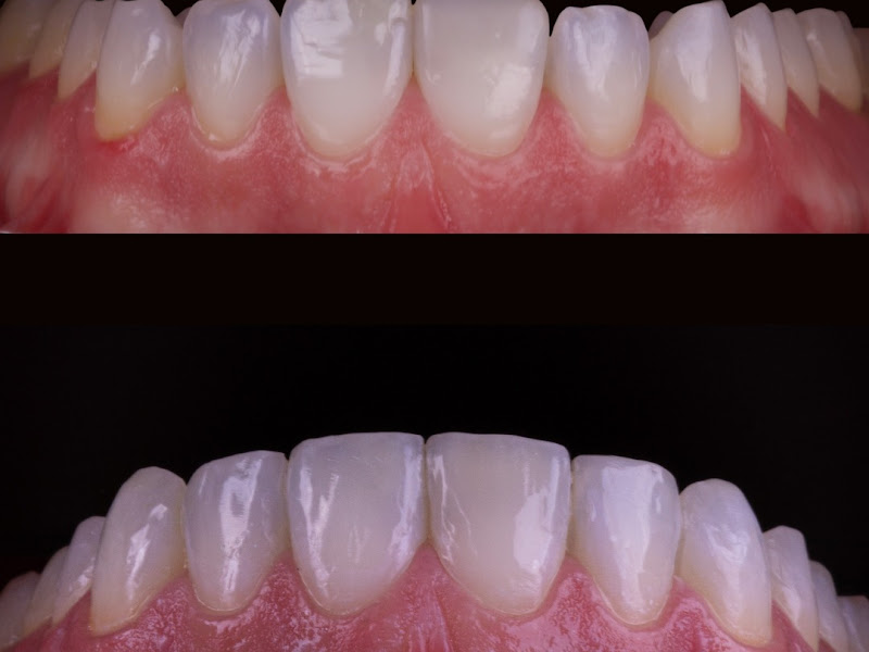 Foto 8 de Dra. Carla Totini | Dentista em Belo Horizonte | Implante dentário, Prótese sobre Implante.