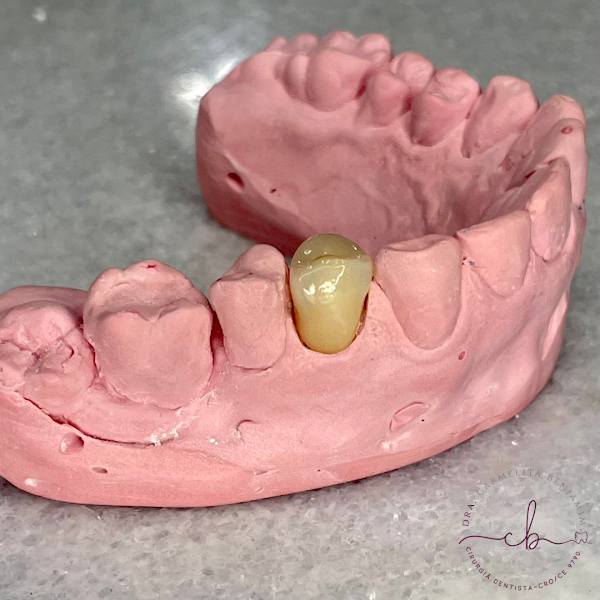 Foto 2 de Dra Carmelita Benjamim