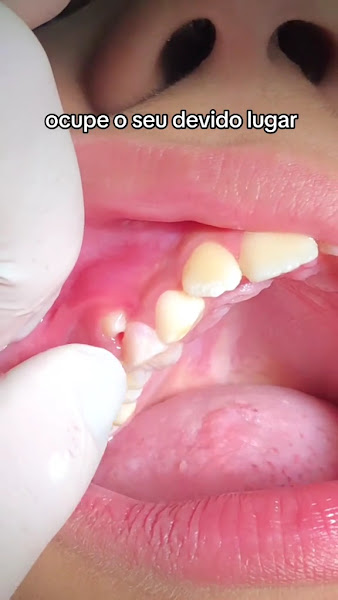 Foto 4 de Dra. Carmen Calixto Odontologia | Invisalign | Dentista na Mooca