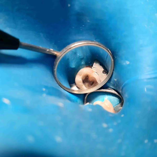 Foto 3 de Dra Carol Alcantara, Dentista na vila maria