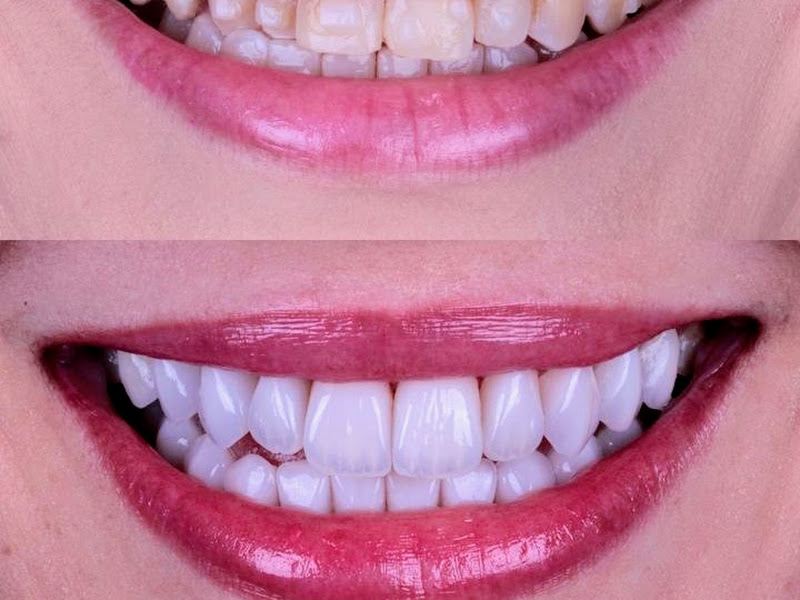 Foto 10 de Dra. Carol Alfenas | Cirurgiã Dentista Campinas SP | +10 Anos Devolvendo Sorrisos