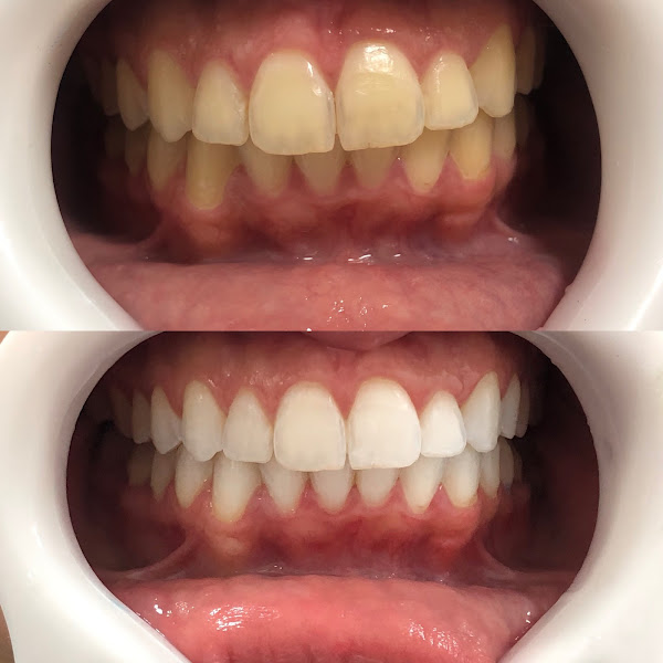 Foto 3 de Dra. Carolina Albuquerque - Dentista Especialista em Reabilitação Oral e Estética