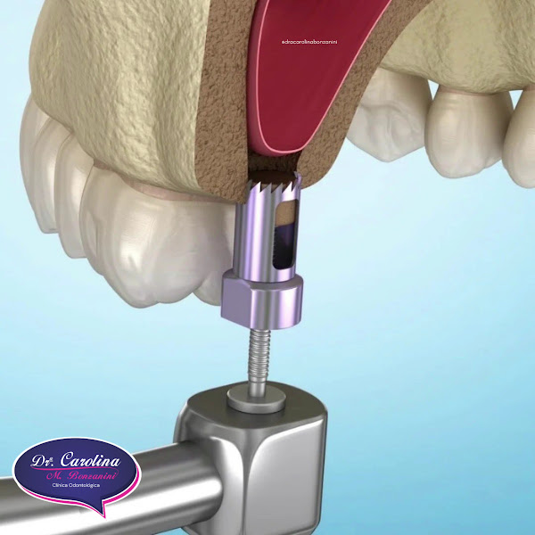 Foto 3 de Dra Carolina Bonzanini