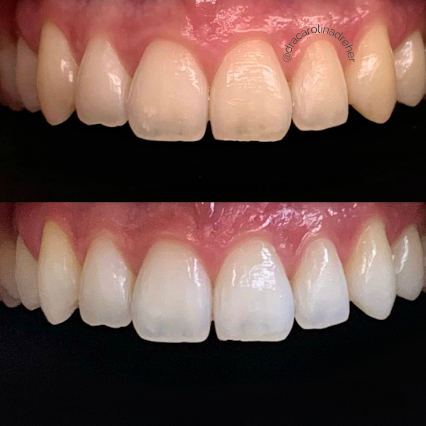 Foto 3 de Dra. Carolina Dreher - Dentista em Curitiba