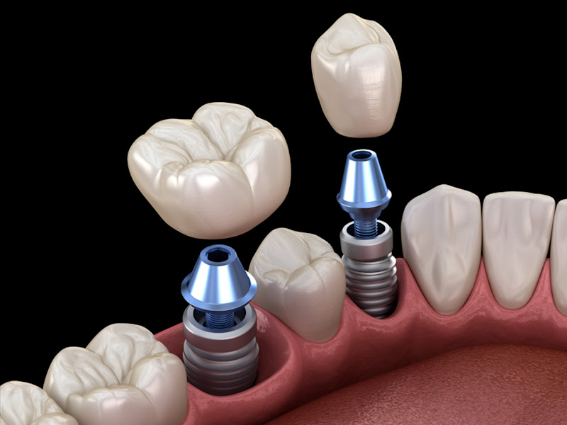 Foto 9 de Dra. Carolina Fernandes - Odontologia