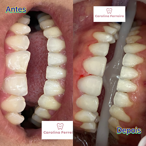 Foto 3 de Dra Carolina Ferreira Odontologia Especializada