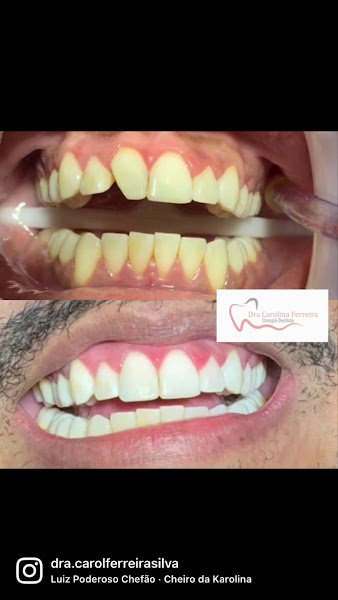 Foto 4 de Dra Carolina Ferreira Odontologia Especializada