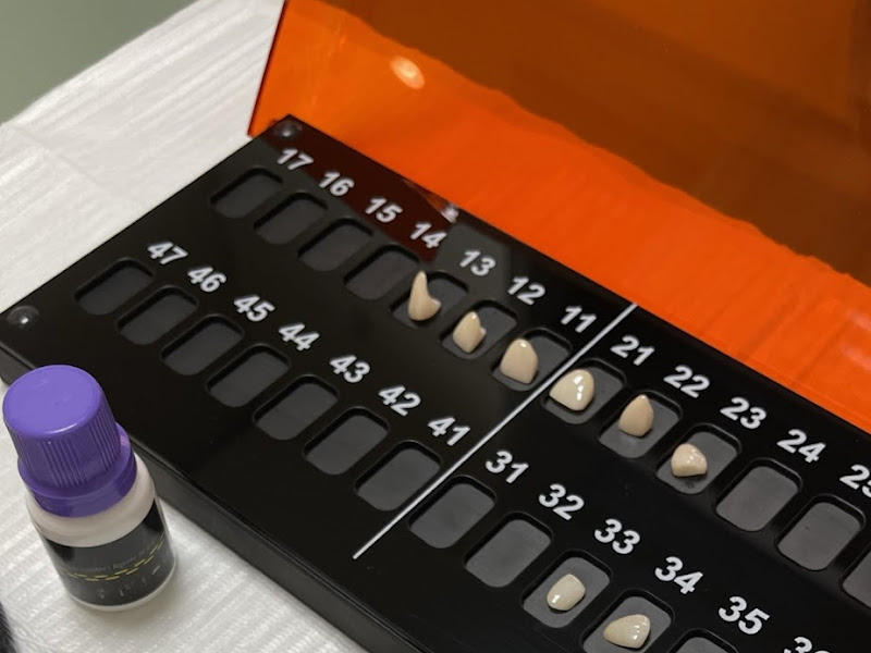 Foto 7 de Dra Carolina Flores | Dentista Menino Deus | Implantes | Próteses | Lentes de Contato | Clareamento Dental