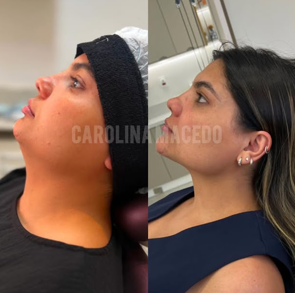 Foto 2 de Dra Carolina Macedo