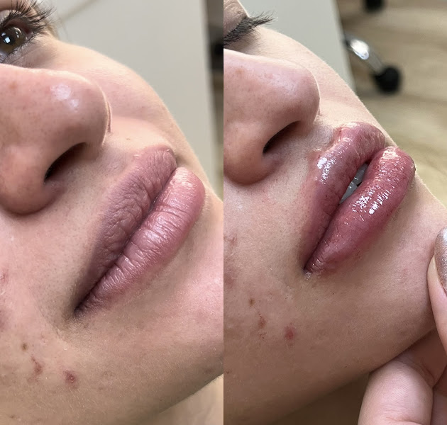 Foto 3 de Dra. Caroline Alves | Dentista Endodontista