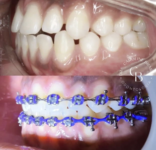 Foto 3 de Dra. Caroline Braido Odontologia