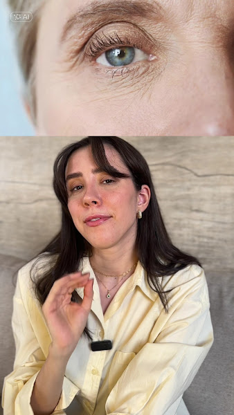 Foto 2 de Dra Caroline Caetano- “Blefaro sem Cirurgia”, Tratamento de Manchas e Harmonização Facial