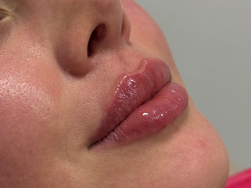 Foto 3 de Dra. Caroline Cruz Harmonização Facial