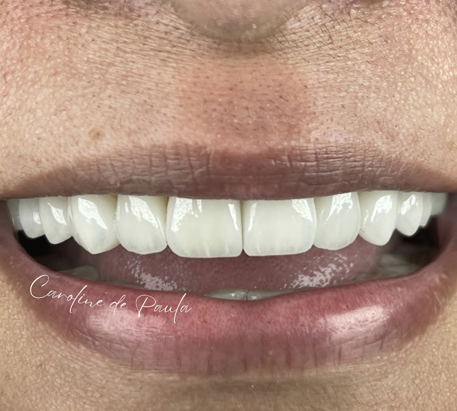 Foto 2 de Dra. Caroline de Paula | Odontologia e Harmonização | Osasco