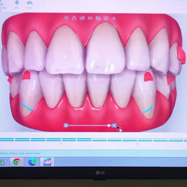 Foto 3 de Dra. Caroline Malavasi, Invisalign, Barra da Tijuca