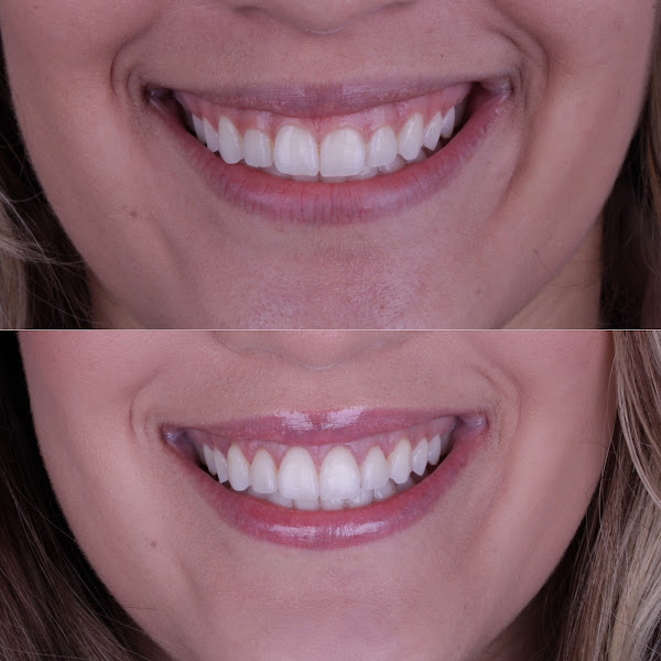 Foto de Dra. Caroline Mara - Odontologia Estética e Harmonização Facial