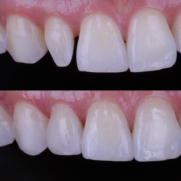 Foto 2 de Dra. Caroline Mara - Odontologia Estética e Harmonização Facial