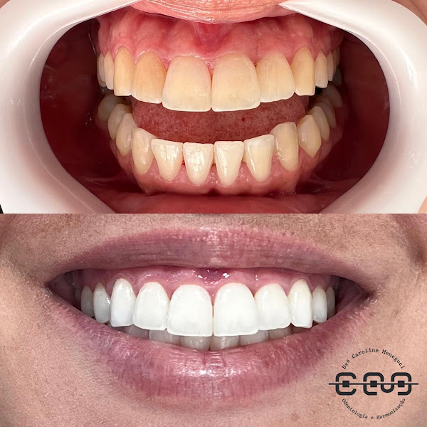 Foto 3 de Dra.Caroline Meneguci