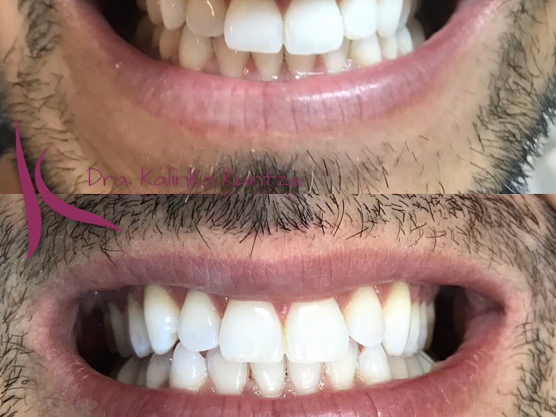 Foto 10 de Dra. Caroline Morgental - Dentista em Balneário Camboriú | Ortodontista | Invisalign