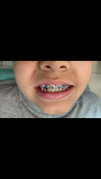 Foto 3 de Dra Caroline Neder |Dentista em Jundiaí| |Invisalign em Jundiaí| |Lentes de porcelana em Jundiaí|