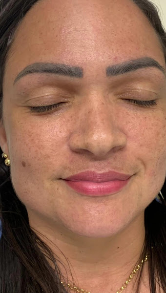 Foto 3 de Dra. Caroline Schramm | Clínica de Harmonização facial em Salvador