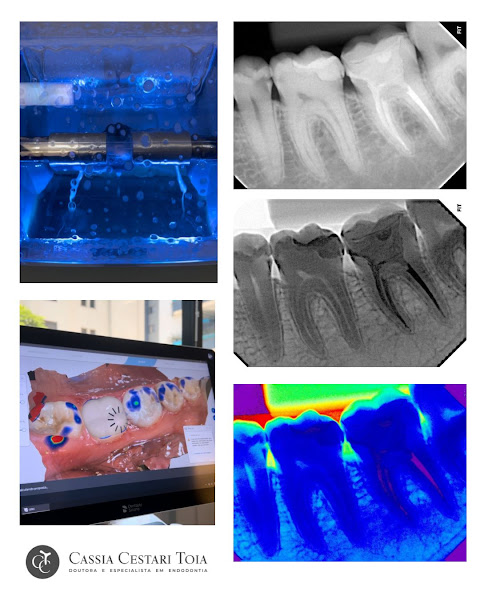 Foto 3 de Dra. Cassia Cestari Toia | Endodontista em São José dos Campos