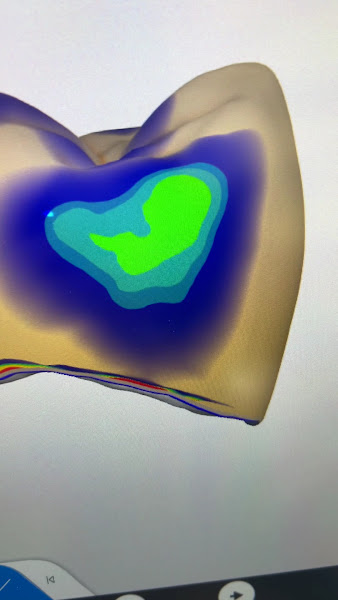 Foto 4 de Dra. Cassia Cestari Toia | Endodontista em São José dos Campos