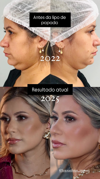 Foto 2 de Dra Catarine Ferreira Oliveira Cirurgiã Dentista