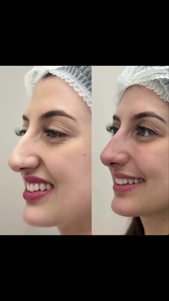 Foto 3 de DRA. CEANE BAGGIO | HARMONIZAÇÃO FACIAL | BOTOX | PREENCHIMENTO | HARMONIZAÇÃO MASCULINA CHAPECÓ