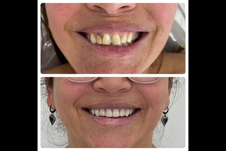Foto 3 de Dra Cibele Kimie Nakaya Dentista especialista em Endodontia, Estética e Implantodontia