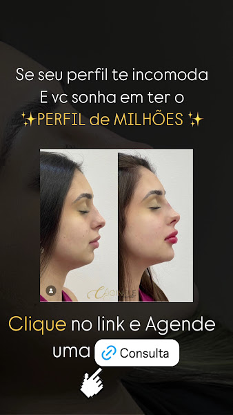 Foto 3 de Dra. Cinele Azevedo | Rejuvenescimento Facial | Especialista em Harmonização Full Face e Perfiloplastia no Rio de Janeiro