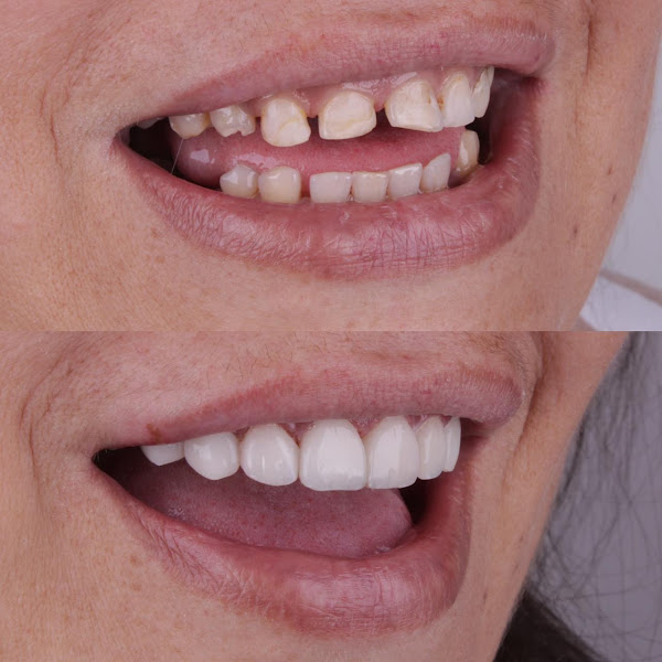 Foto 2 de Dra. Cinthia Cintra | Cirurgiã - Dentista