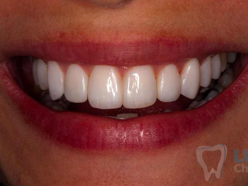 Foto 3 de Dra. Cinthya Carvalho Odontologia e Estética