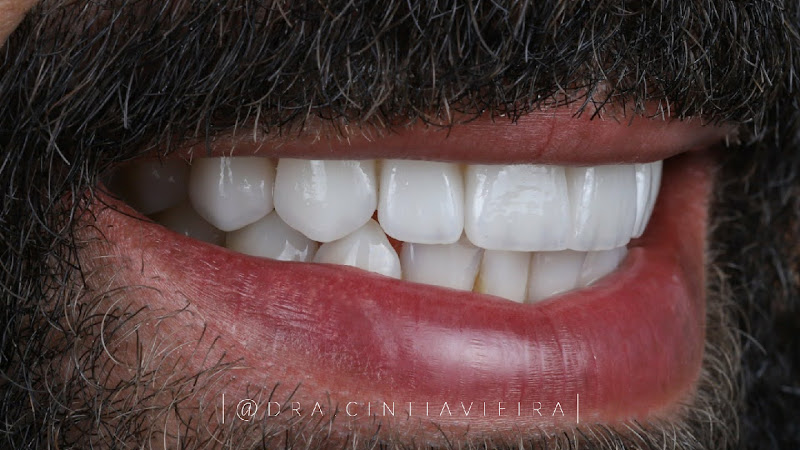 Foto 2 de Dra Cíntia Huss - Dental Clinic : Implante dental | Lente de contato dental | Prótese