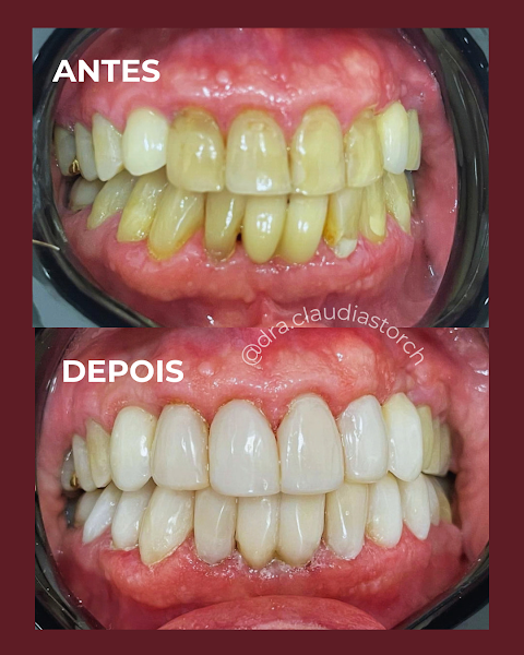 Foto 2 de Dra. Claudia Curbani Storch - Dentista em Linhares ES