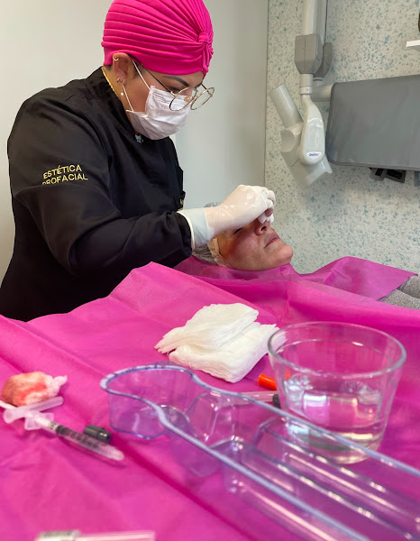 Foto 3 de Dra. Claudia Santos | Cirurgião Dentista, Harmonização Facial e Implantodontia