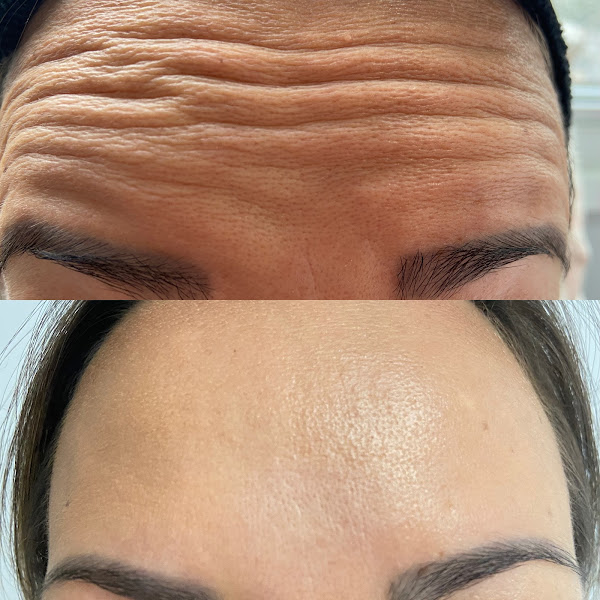 Foto 3 de Dra. Claudia Verônica Teizen | Hamonização Orofacial