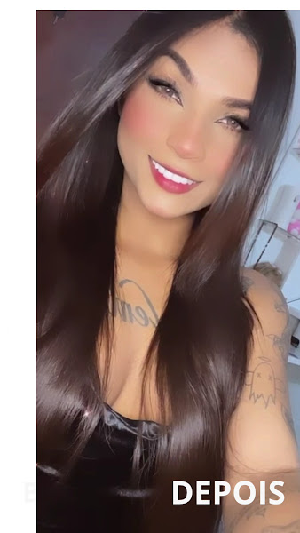 Foto 3 de Dra. Cleyjane Araújo - Harmonização facial