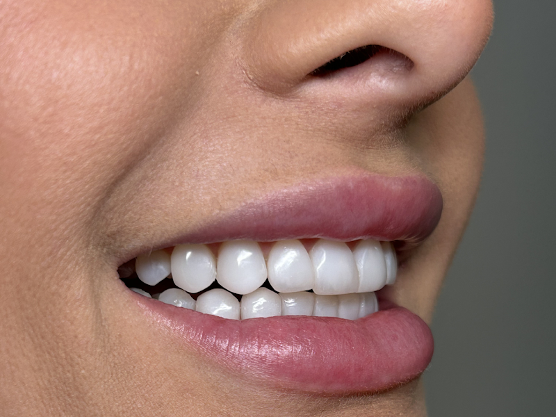 Foto 3 de Dra. Cristhina Silva (DENTISTA)
